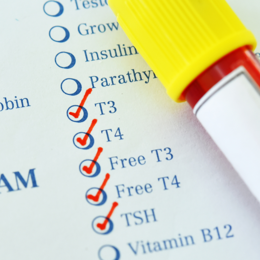 Blog Pictures Affiliate9