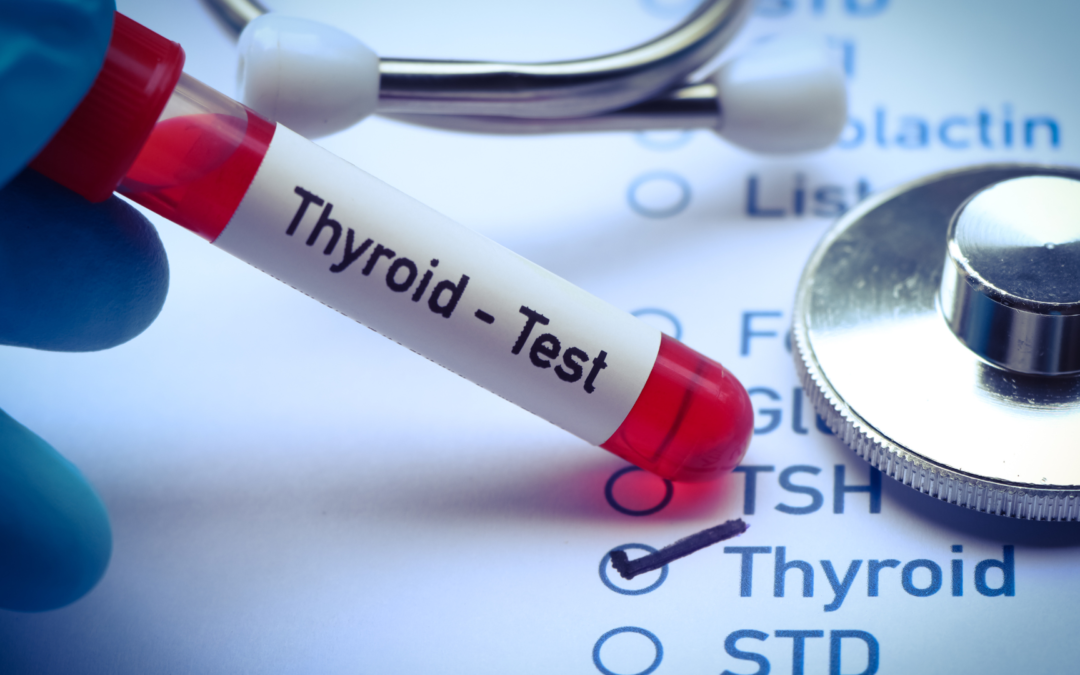 Beating Hypothyroidism: How I Got My Life Back