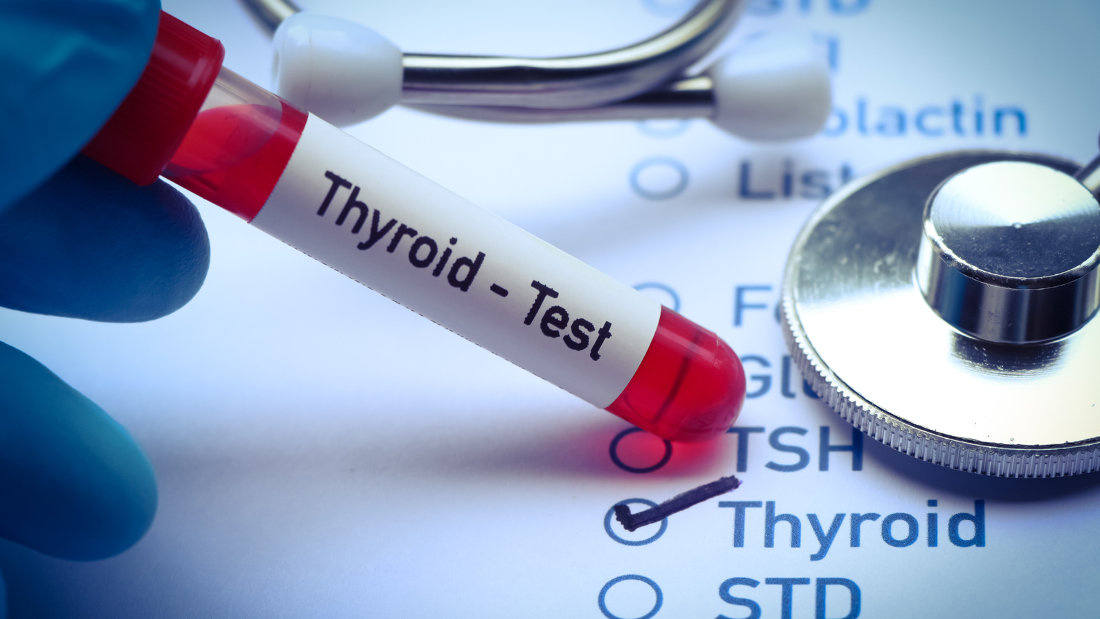 Hypothyroidism